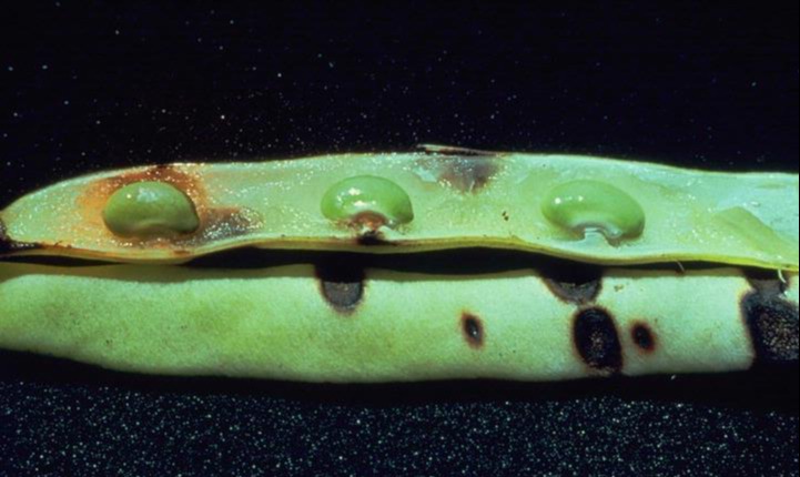 Fasulye Antraknozu (Colletotrichum lindemuthianum)