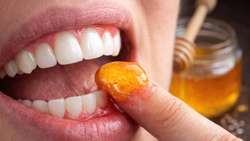Diş Eti Sorunlarına Doğal Çözüm: Diş Etlerine Bal Sürmenin Faydaları